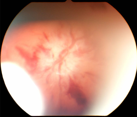 image of retinal, description below
